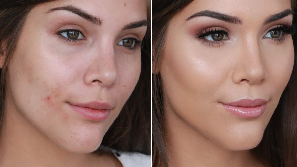 How To Make a Pimple Disappear With Makeup